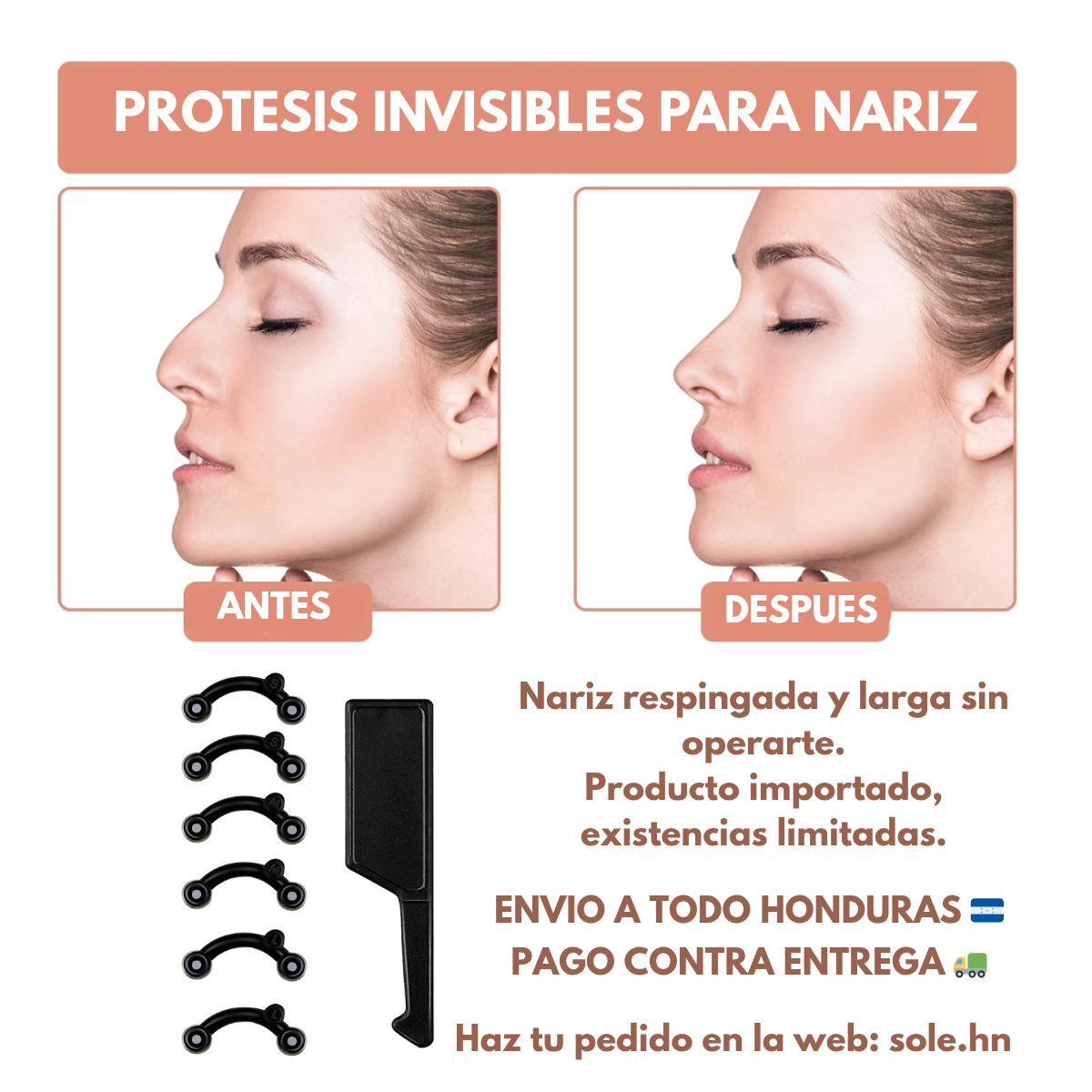 Correctores de nariz (levantadores)
