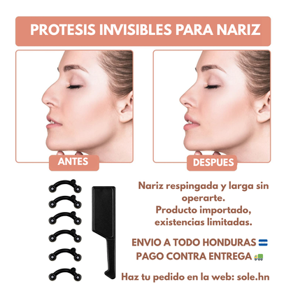 Correctores de nariz (levantadores)